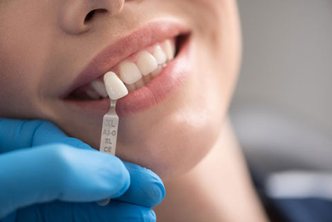 Dental Implants West Chester, PA